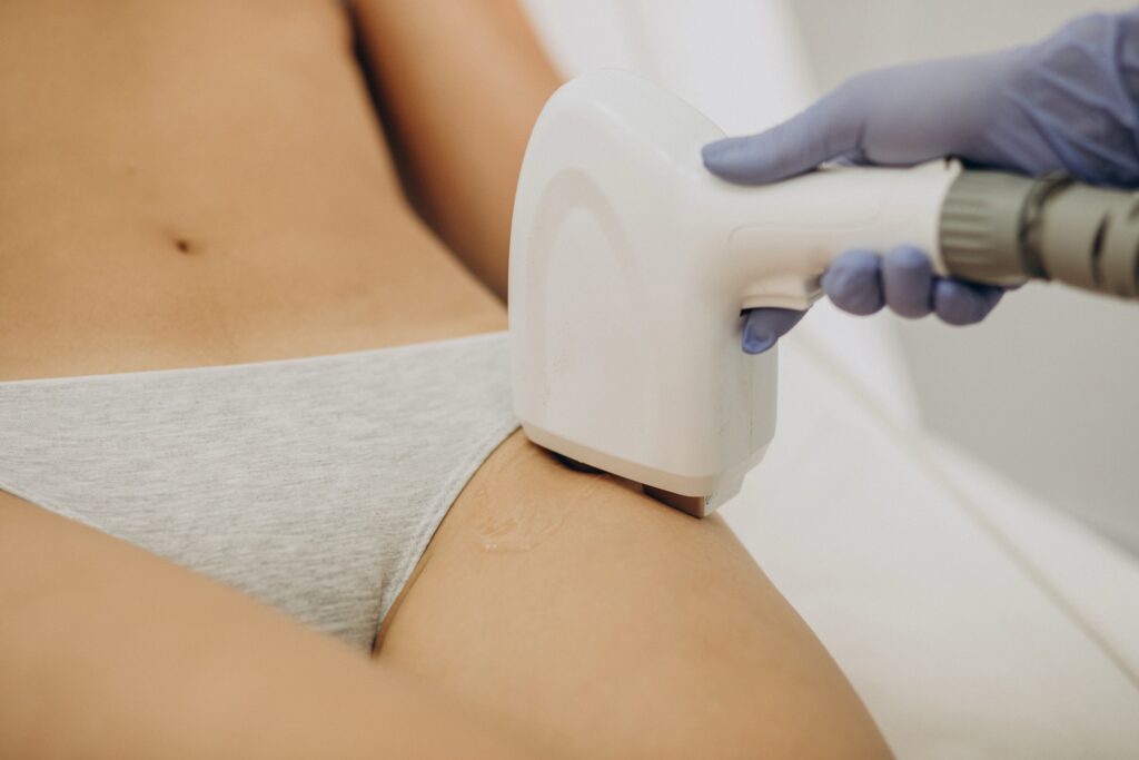 laser-hair-removal-miami-prices-results