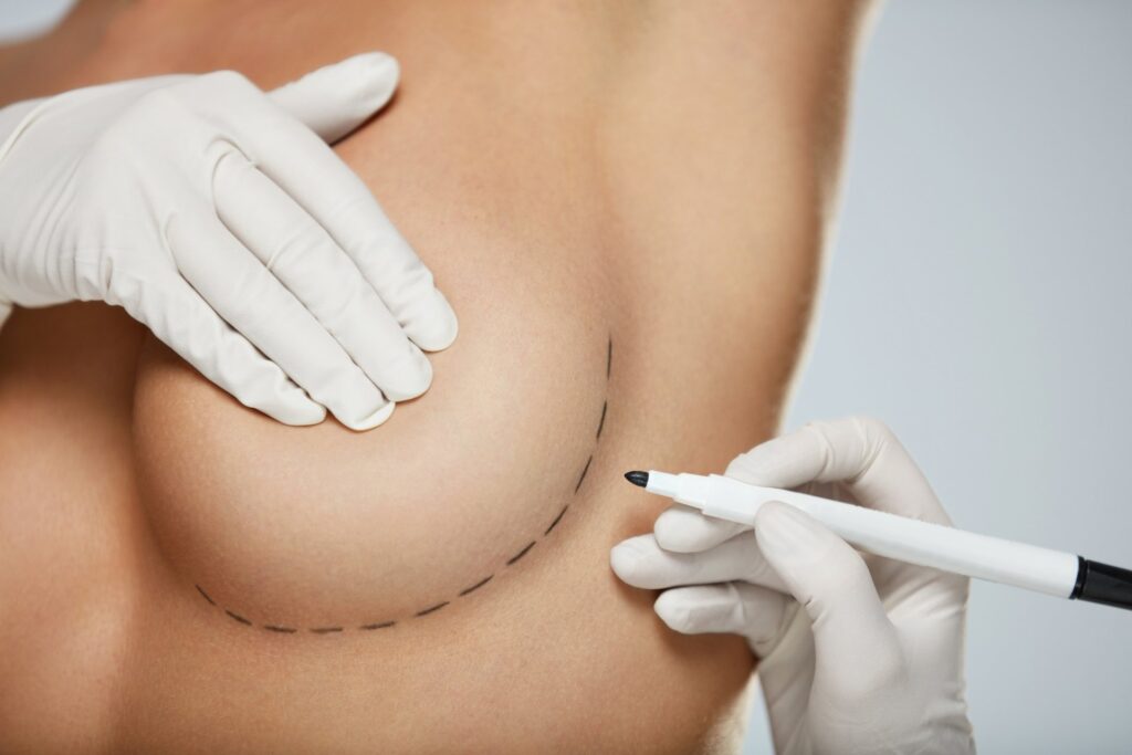 breast-reduction-miami-price